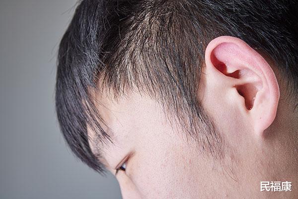 |头发“一天一油”，是什么原因？如何缓解？“油头”的人看过来