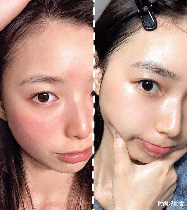 时尚好物官|有一种整容叫“吴昕护肤”，痘痘消失皮肤变白，私下坚持用美容仪