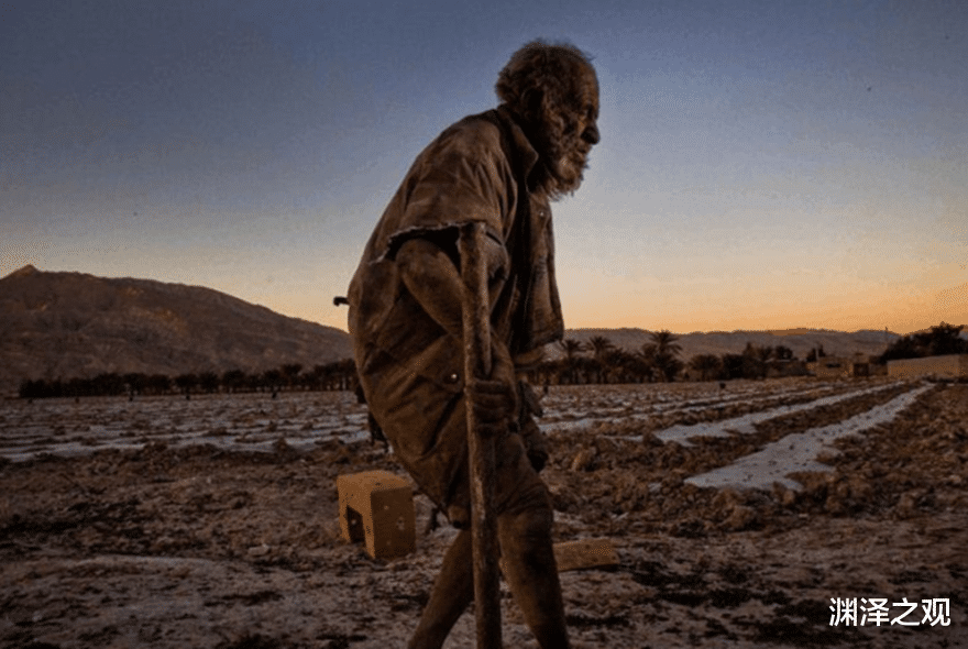 吉尼斯世界纪录 老人因60年不洗澡打破吉尼斯纪录，身体就像裹了铠甲，是何原因？