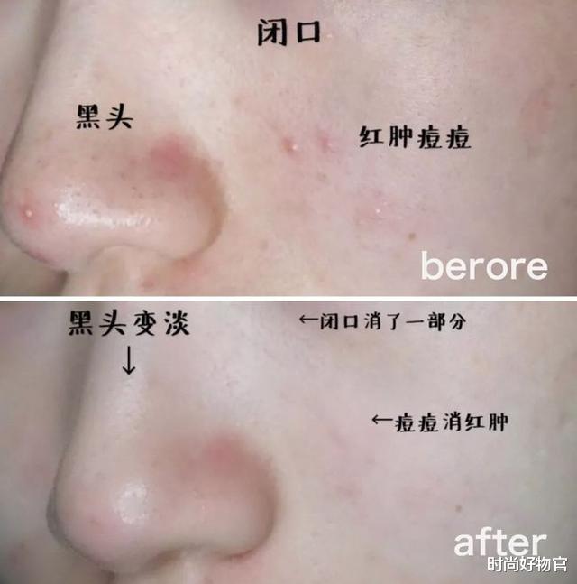 时尚好物官 建议女人：这3种“洗面奶”慎重购买，虽销量不低却存在很多问题