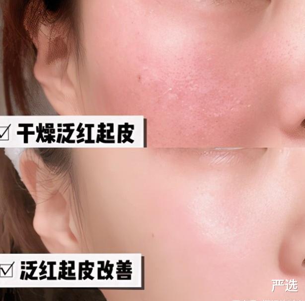 严选 提醒女生：护肤时不要把水、乳、霜的使用顺序用错，不然效果不好