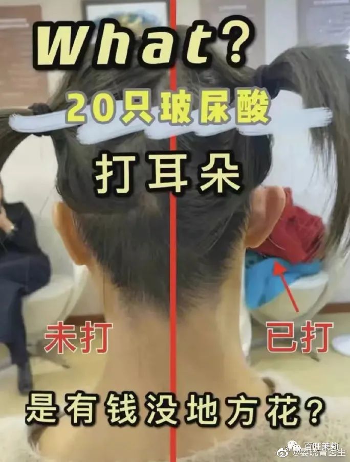 整形|割阴、挑筋、断骨、割胃，那些为了美不要命的女人到底有多可怕