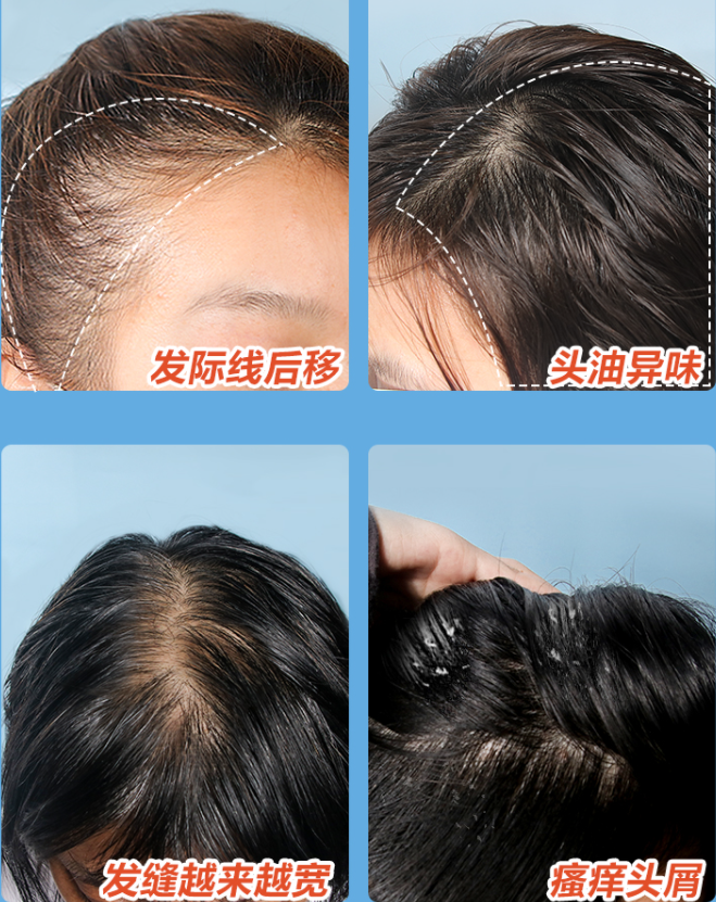 鼓楼 继“阿道夫”后，中国又一“平价”洗发水走红！高质低价力压清扬海飞丝！