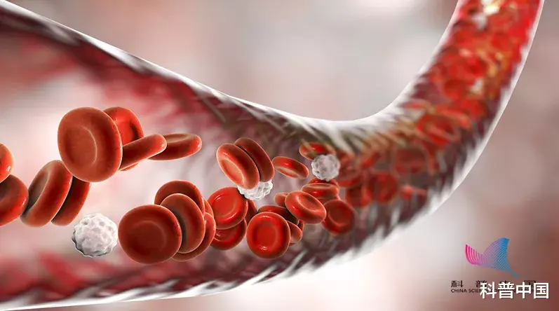 肺炎|这根血管堵了最容易被忽略!脑梗、脑中风都与它有关…