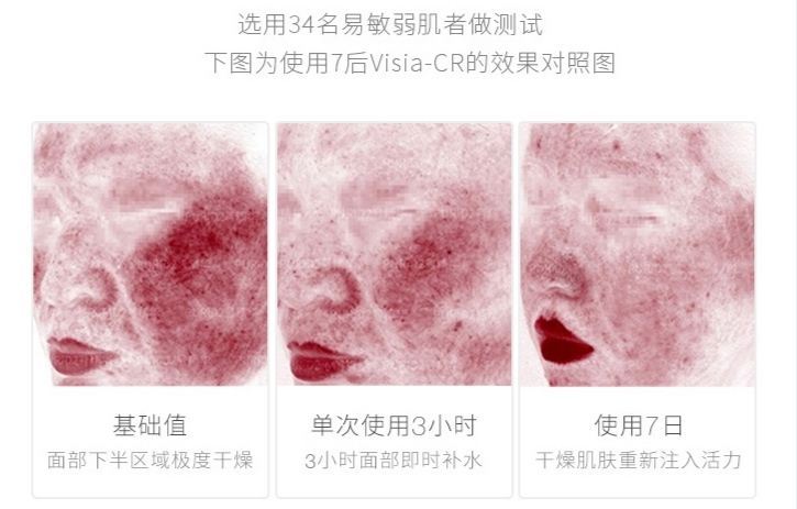 医生|夏天别乱用护肤品，试试这5款热门护肤品，清爽不黏腻，好用不贵