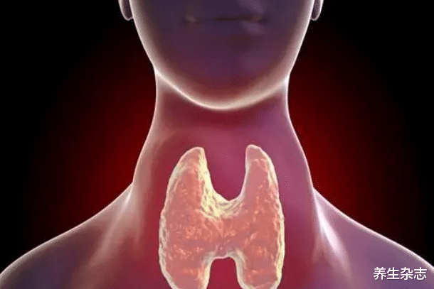 甲状腺肿瘤|52岁大姐爱吃一“零食”,甲状腺肿瘤越来越小,医生:值得借鉴