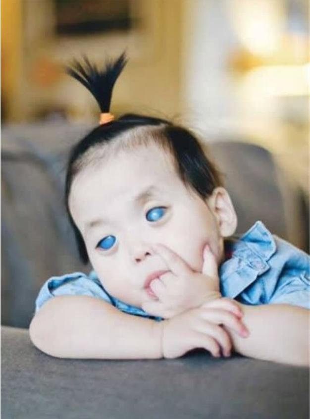中國女孩一出生是“藍眼睛”被拋棄，美國夫婦跨國領養，如今怎樣-圖3