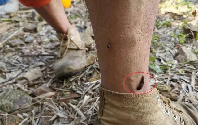 超导 水蛭是如何叮人的？被水蛭叮是种什么体验？