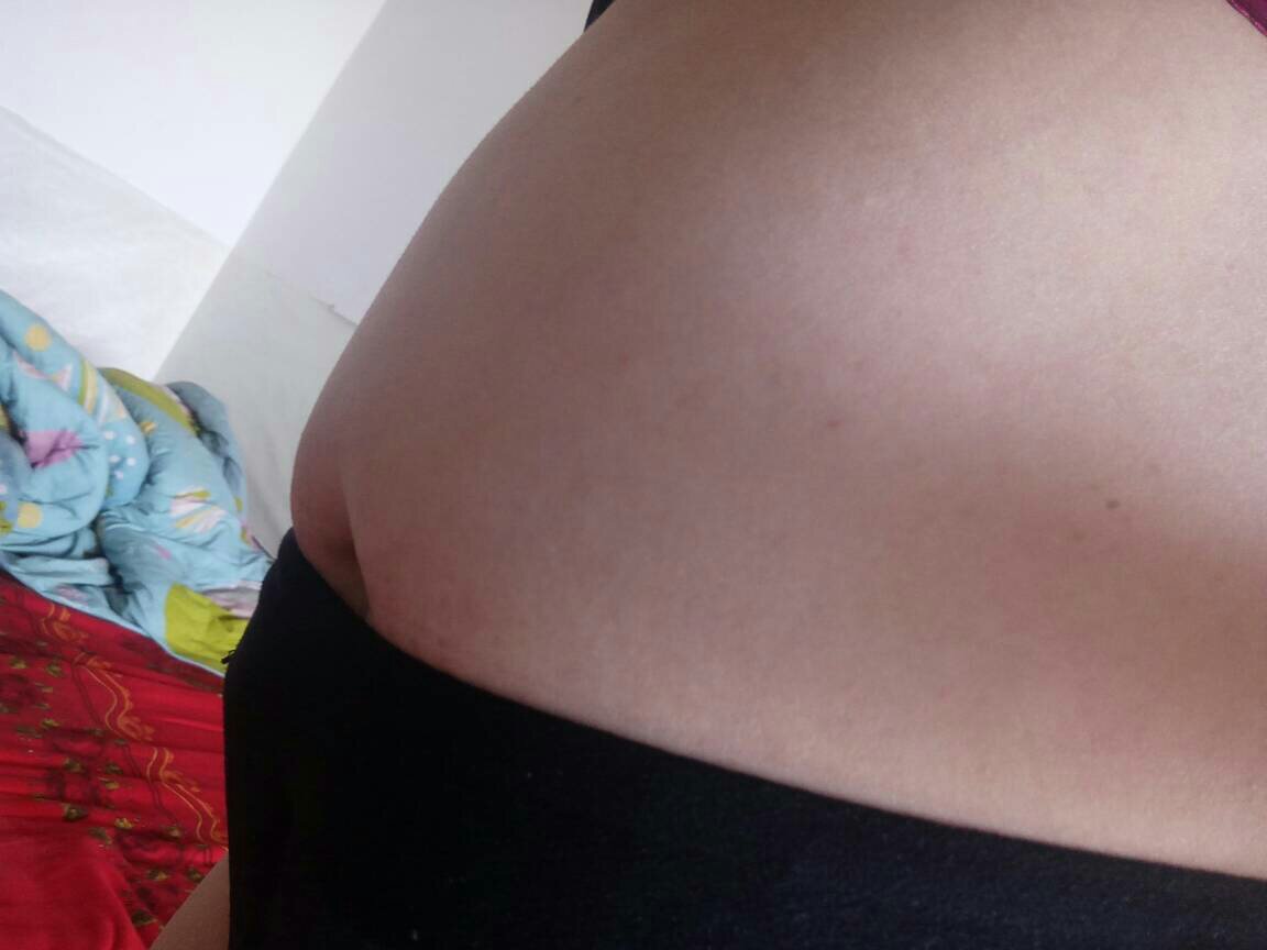 妊娠纹|女人生没生过孩子，明眼人一瞅就知道，这几个部位早已“出卖”