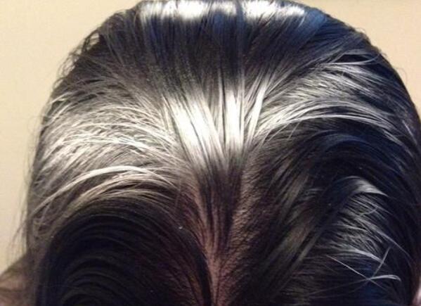 爱吃糖果的辣妈|掏心窝囤货分享丨孕期告别油扁塌，全靠这几款洗发水，孕妈可用