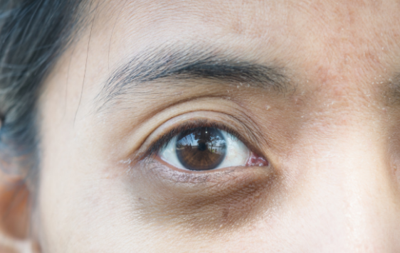 癫痫病|肝若变硬，头部先知，肝科专家提醒：头部有这4种表现，趁早做肝CT