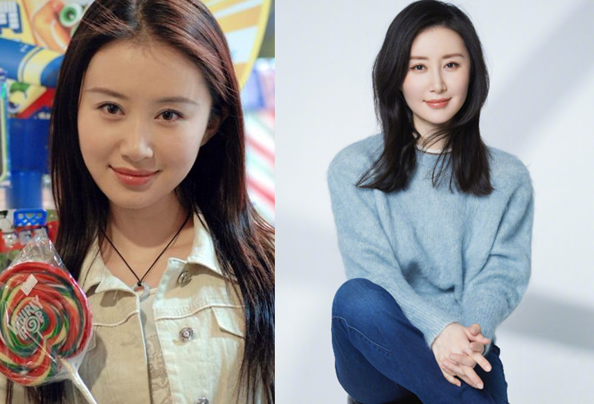 整容|娱乐圈整容失败的十大女星，郑爽为了爱情，而她是因为观众吐槽