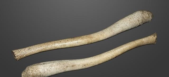 基因突变 人类为何失去了“丁丁骨”？这种进化属于退步，还是优势？