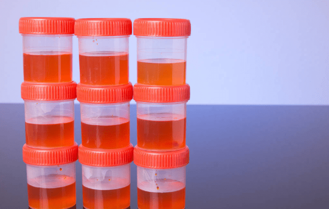 蔬菜|加速肾病到尿毒症的4大误区,别不当回事儿,等肾衰竭就晚了