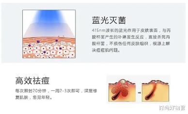 时尚好物官|为变美打“美容针”真的值得么？过来人说出心里话，得不偿失