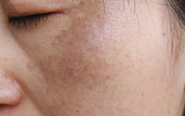 肝脏|男性早起有3现象,肝脏或已“烂如蜂巢”,一个不占,肝还算健康