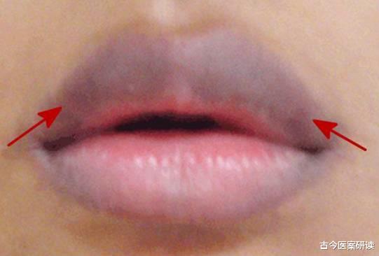 咳嗽|肺最爱“一种水”，不是雪梨水，你若爱喝，清肺润肺，肺脏一尘不染