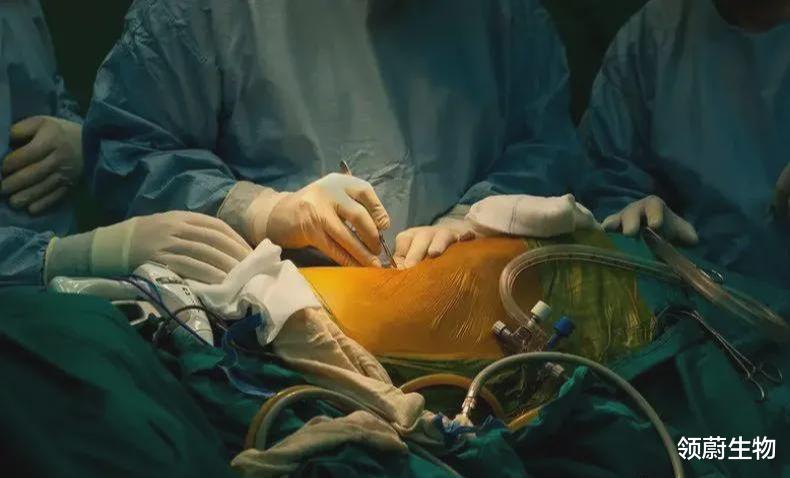 肾移植 世界首例   输注干细胞助力肾移植获成功，免疫耐受长达18个月