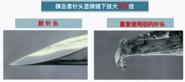 科普作者孙医生|老人坚持打胰岛素血糖仍不降，腹部拳头大肿块疼痛难忍，原因使人心疼