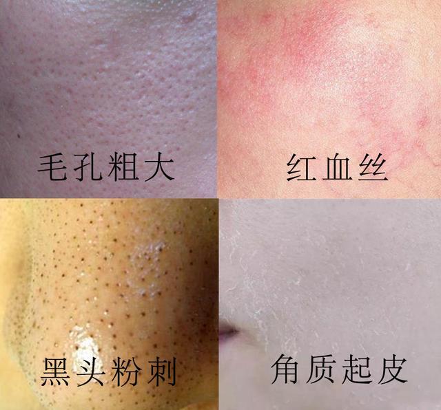 好物官|吴昕皮肤光滑白皙，坚持每天用它洗脸，3次就能“震”毛孔垃圾