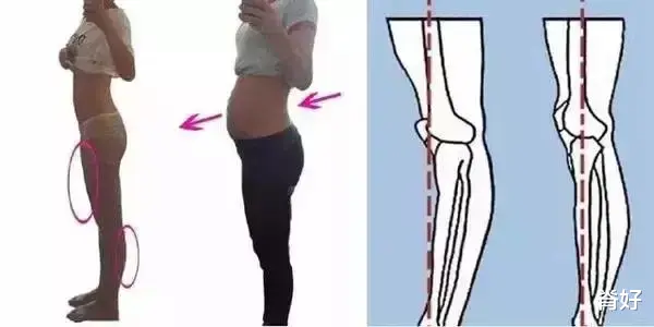 医院|美女练腿被围观进医院，庸医：这种腿别乱练