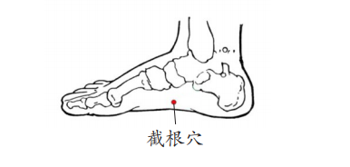食管癌|太突然!著名演员从确诊到离世仅一月!45岁后都要特别注意