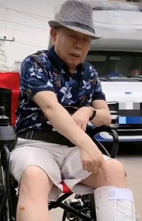 潘长江|继赵钟祥离世后,潘长江也传来不好消息,网友:敬业精神令人赞叹