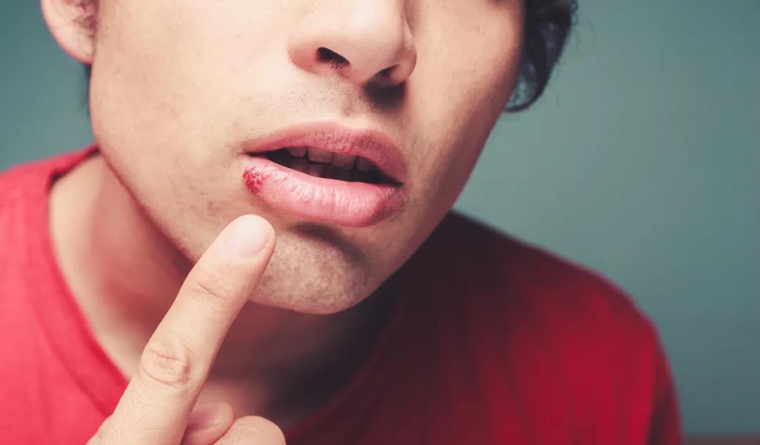 百艾堂|未来30天清热灭火就是招病！把你的虚火收起来，滋养五脏！