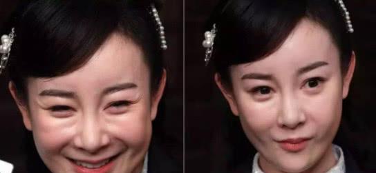 整容|8位“整容变毁容”的女明星，以前美貌动人，如今僵硬成网红