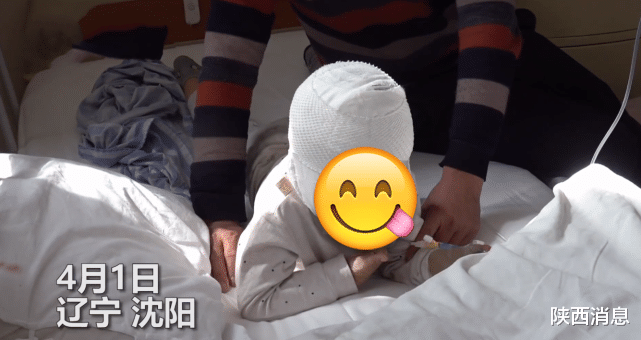 陕西消息 通辽：4岁男童被自家狗咬伤，头面部缝80多针 ，可能导致面瘫