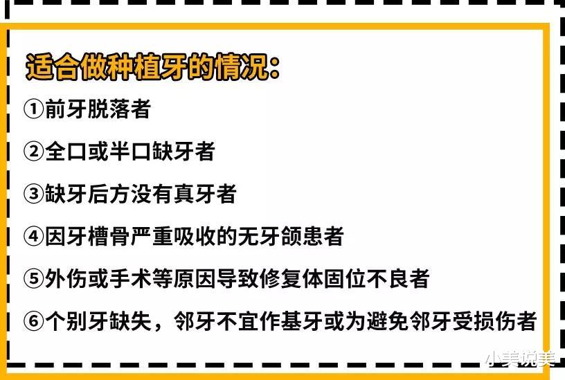 小美说美 老人才种牙?听28岁患者分享自己的心酸种牙经历