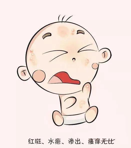 塑造美好的自己|宝宝在得了湿疹以后有绝对不能吃的食物吗
