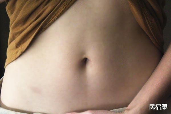 细菌感染|肚脐眼中的“黑泥”是什么?用手抠掉,可以吗?