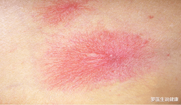 罗医生说健康|男子乙肝15年,每年体检正常,现查出肝癌,医生:他忽略了两件事