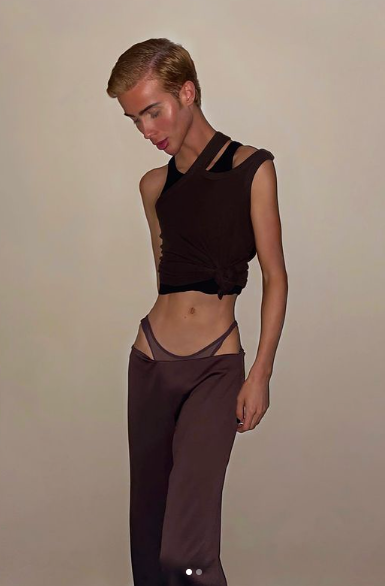 |男星莫名暴瘦自称一切正常，网友们不淡定了：这瘦得诡异