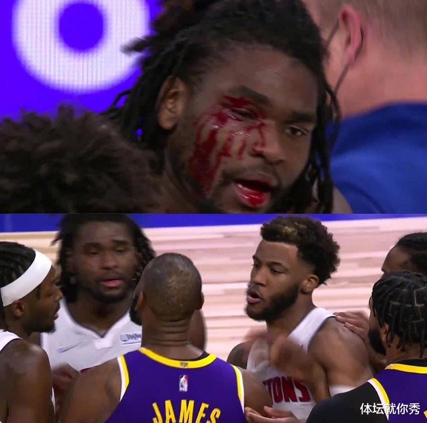 世界冠军|NBA第一硬汉！一人硬刚湖人三巨头，6人都拉不住，这梁子是结下了