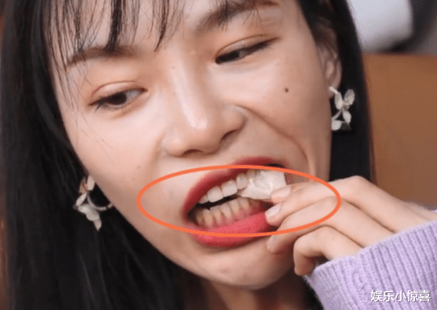 小贝|为何“小贝饿了”越吃越瘦？粉丝说出缘由，全网欠她一句对不起