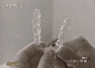 穴位|到底是我在整牙，还是牙在整我？