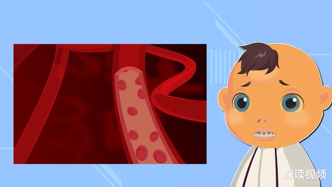 基因 1.9%的人带有致病基因，地中海贫血太神秘？动漫解读