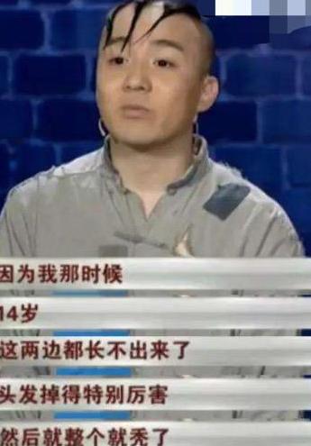 孟智超|他凭“三毛”一夜爆红，后因谢顶缝合300针，今容貌大变已无人识！