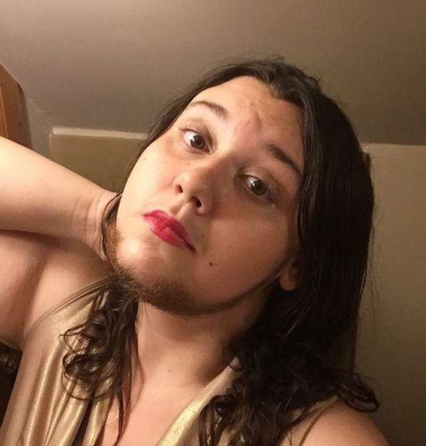 美国|美国女子毛发旺盛，曾感到很羞愧，如今大方晒出胡子觉得自豪