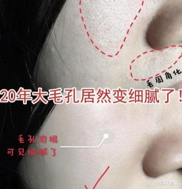 时尚好物官|吴昕晒“保命”美容仪！从“乡土”变“高端”，网友：见证奇迹