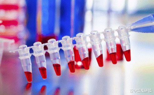 尿酸|卫生组织呼吁：禁止食用“1早餐”，嘌呤比猪油高50倍，尽量少吃