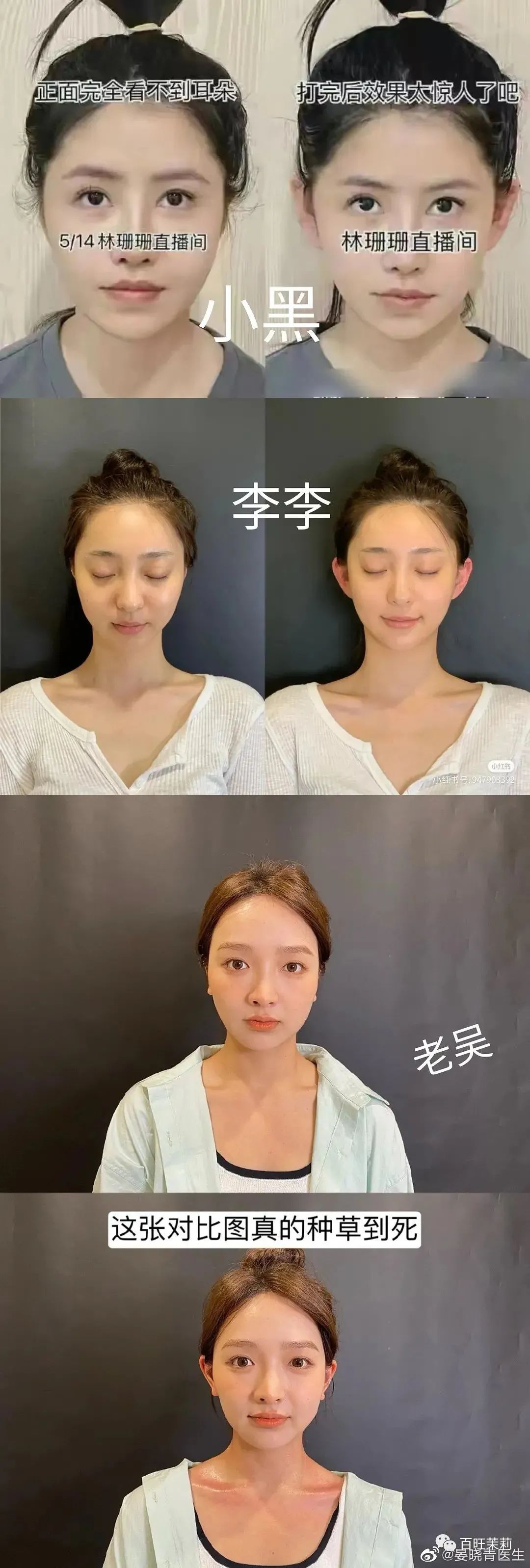 刘海|割阴、挑筋、断骨、割胃，那些为了美不要命的女人到底有多可怕