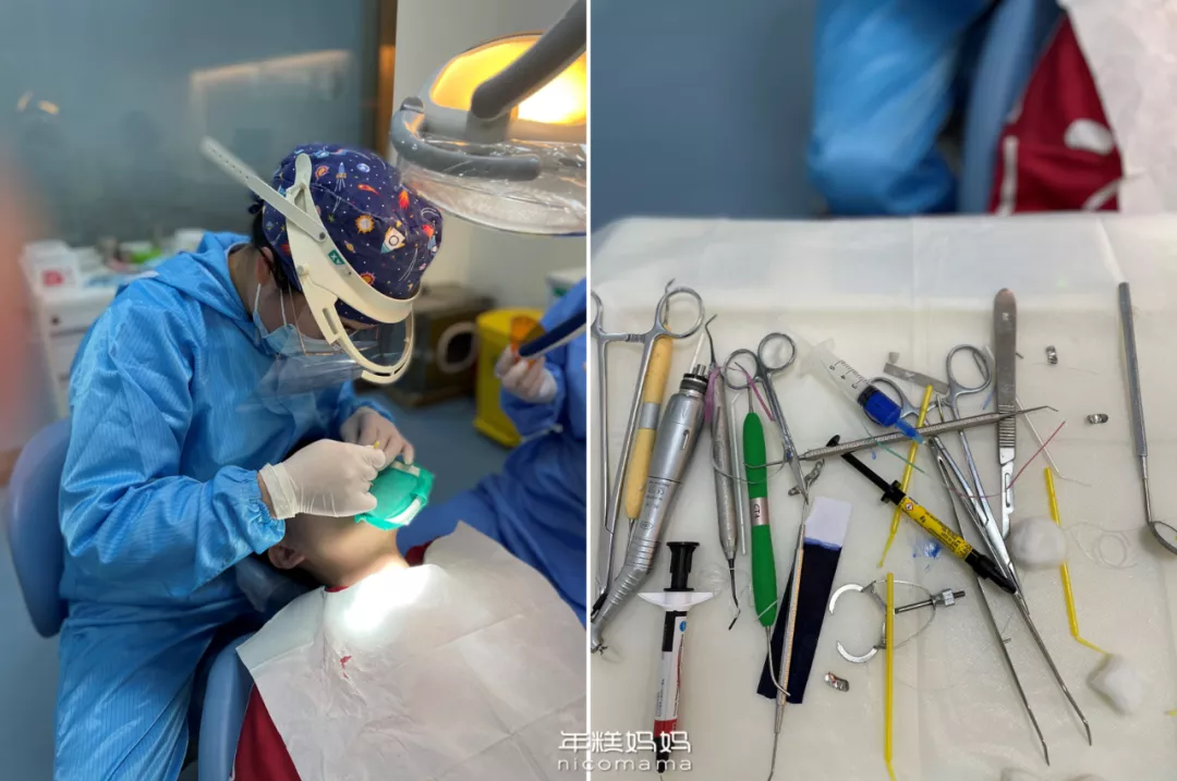 婴幼儿常识|国药育儿知识：现在牙齿有问题的人太多了！个个成了口腔门诊的常客！