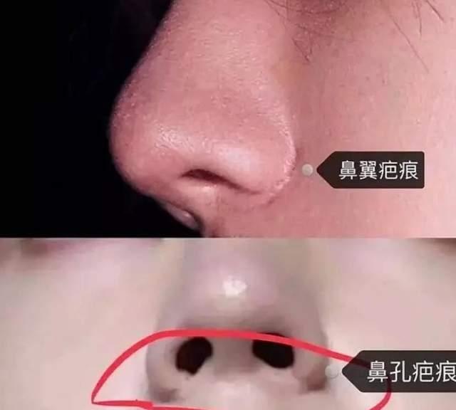 王一博|王一博鼻子透光引热议，医生曾指其缩鼻翼，多位明星因此被疑整容