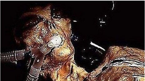 科学家 美国收集了三十多具外星人的遗骸