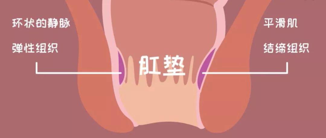 xx爱睡觉|导致痔疮的四大主要因素都有哪些？缓解痔疮都有哪些方法？