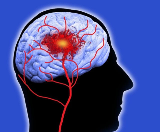 痛风|老年人为啥容易惹上脑梗？45岁后，2种蔬菜请舍得吃，让血管更柔软