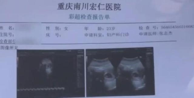 横相周刊社 重庆一女子做整容手术，术后2天恶心呕吐，医院检查竟然怀孕了